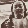 蛋子皮