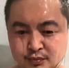 大蒜鼻子