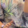 扁桃体发言